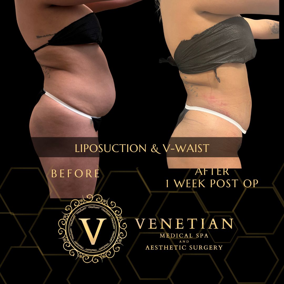 Allan Website Before and After Photos